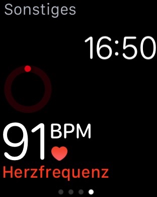 Unterschiedliche Intervalle bei Pulsmessung laut Support-Dokument kein Fehler-img_1305.jpg