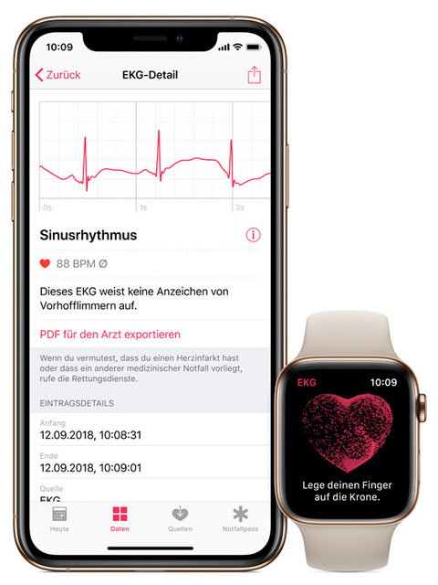 Apple Watch Series 4 - EKG Funktion-iphone-watch-ecg-chde.jpeg