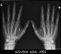 NFC Implantate und die Möglichkeiten auf meinem OnePlus One-b7qde5siqaaa97e.jpg