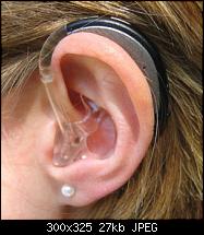 Juchu es kommt (Idee von Spline)-behinderung_schwerhoerig.jpg