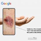 THERE IS A 75% CHANCE THAT THIS SKIN REGION INCLUDES A MELANOMA elegant REPORTED BY hoopoe IN COLLAB WITH XLEAKS7